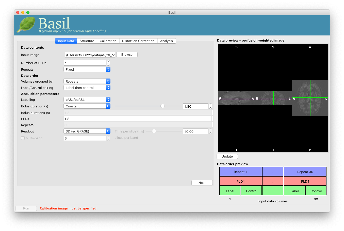 BASIL GUI previewing perfusion-weighted image